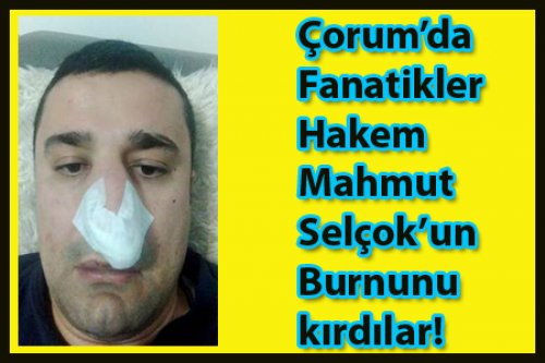 FANATİKLER ÇORUM'DA HAKEMİN BURNUNU KIRDI!