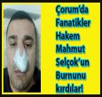 FANATİKLER ÇORUM'DA HAKEMİN BURNUNU KIRDI!
